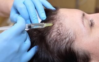 The Magic Behind PRP Therapy