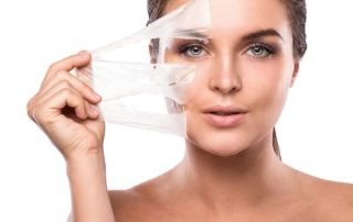 What are Chemical Peels